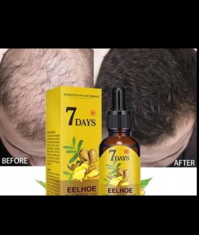 Venda Vendo Óleo para crescimento do Cabelo
